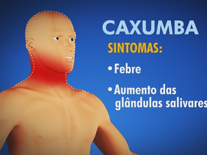 caxumba