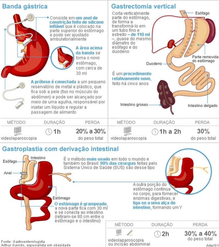 bariatrica